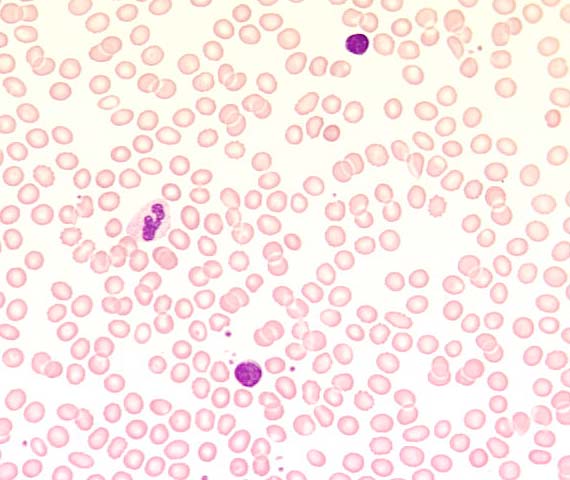 Bild von Blutkörperchen